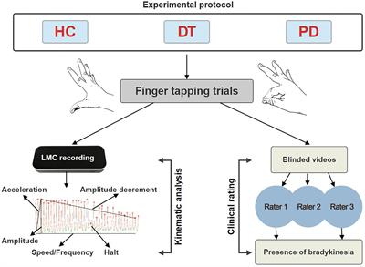 Bradykinesia in dystonic hand tremor: kinematic analysis and clinical rating